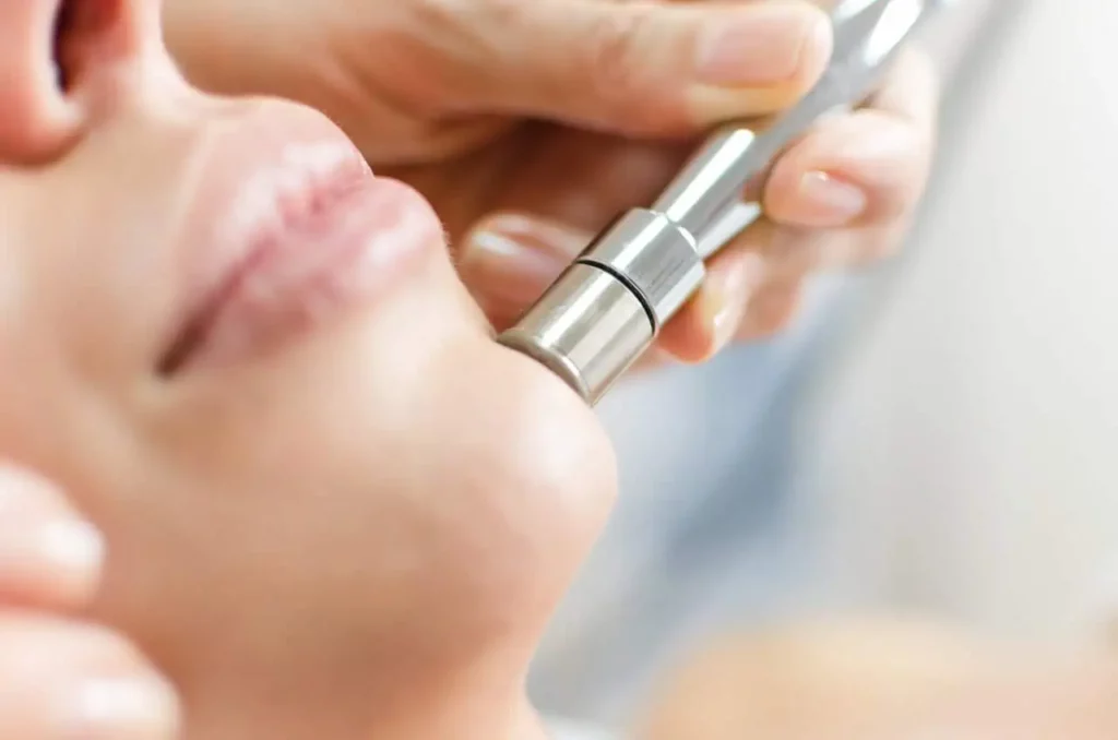 Microdermabrasion in Warren OH | Youthology Med Spa