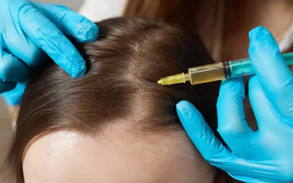 Advanced Hair Restoration in Warren OH | Youthology Med Spa