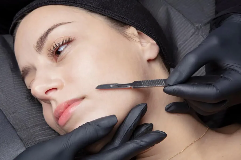 Dermaplaning in Warren OH | Youthology Med Spa