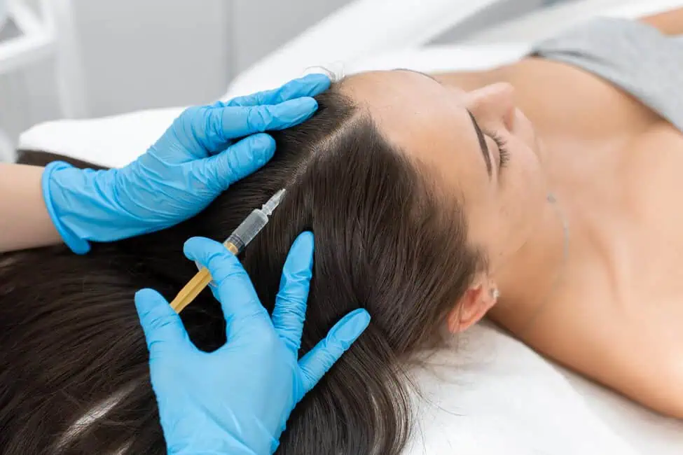 PRP Hair Restoration by Youthology in Warren, OH