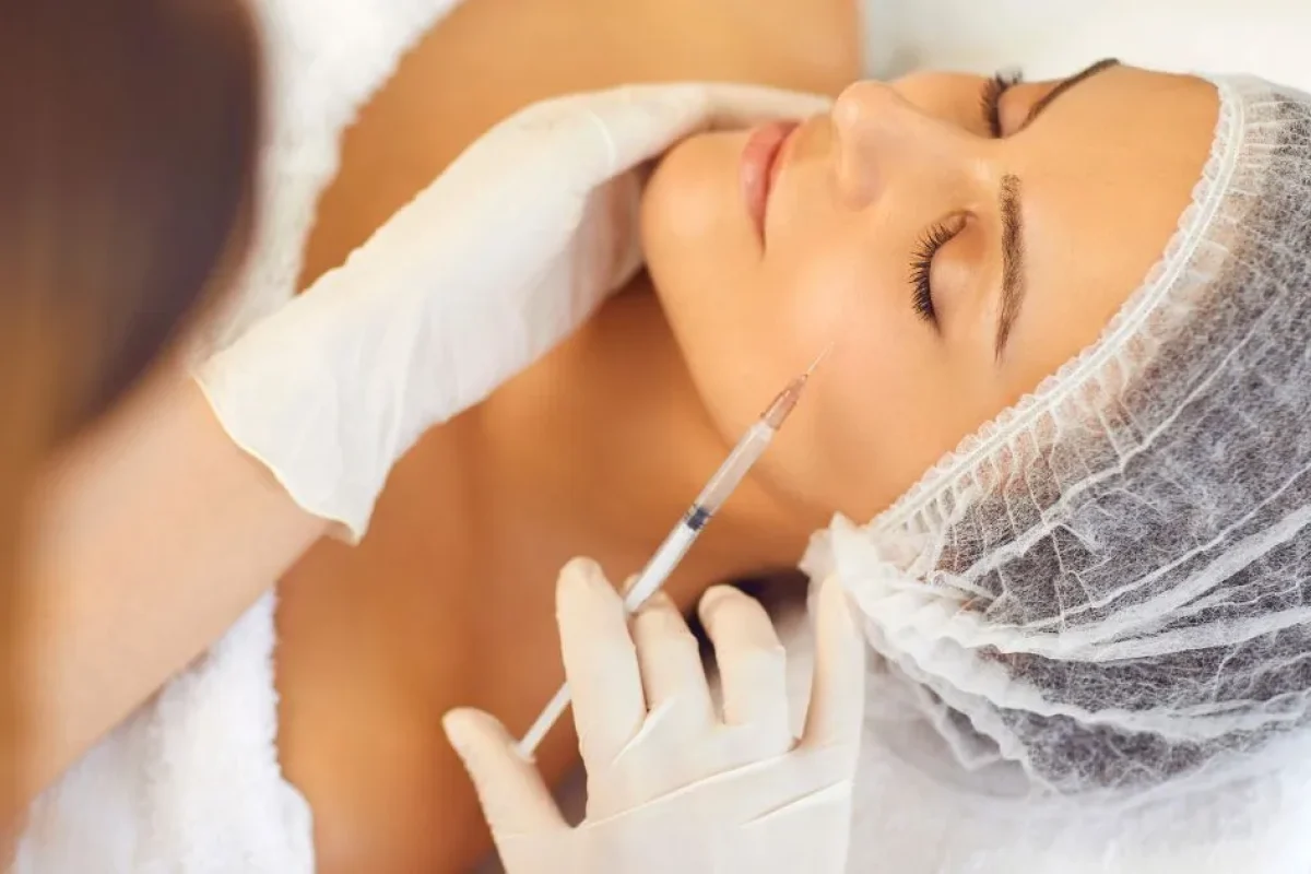 Bellafill dermal filler injection on a woman's cheek in Warren, OH clinic